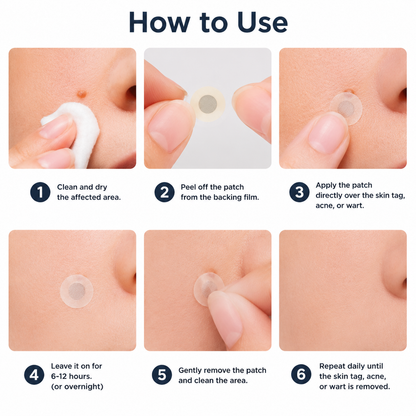 🔥Muwix®2-in-1 Microneedle & Hydrocolloid Patch🍀| Removes Raised Moles, Acne, Flat Warts & Skin Tags | Helps Improve Wrinkles, Scars & Blemishes | Invisible Patches for Face & Body