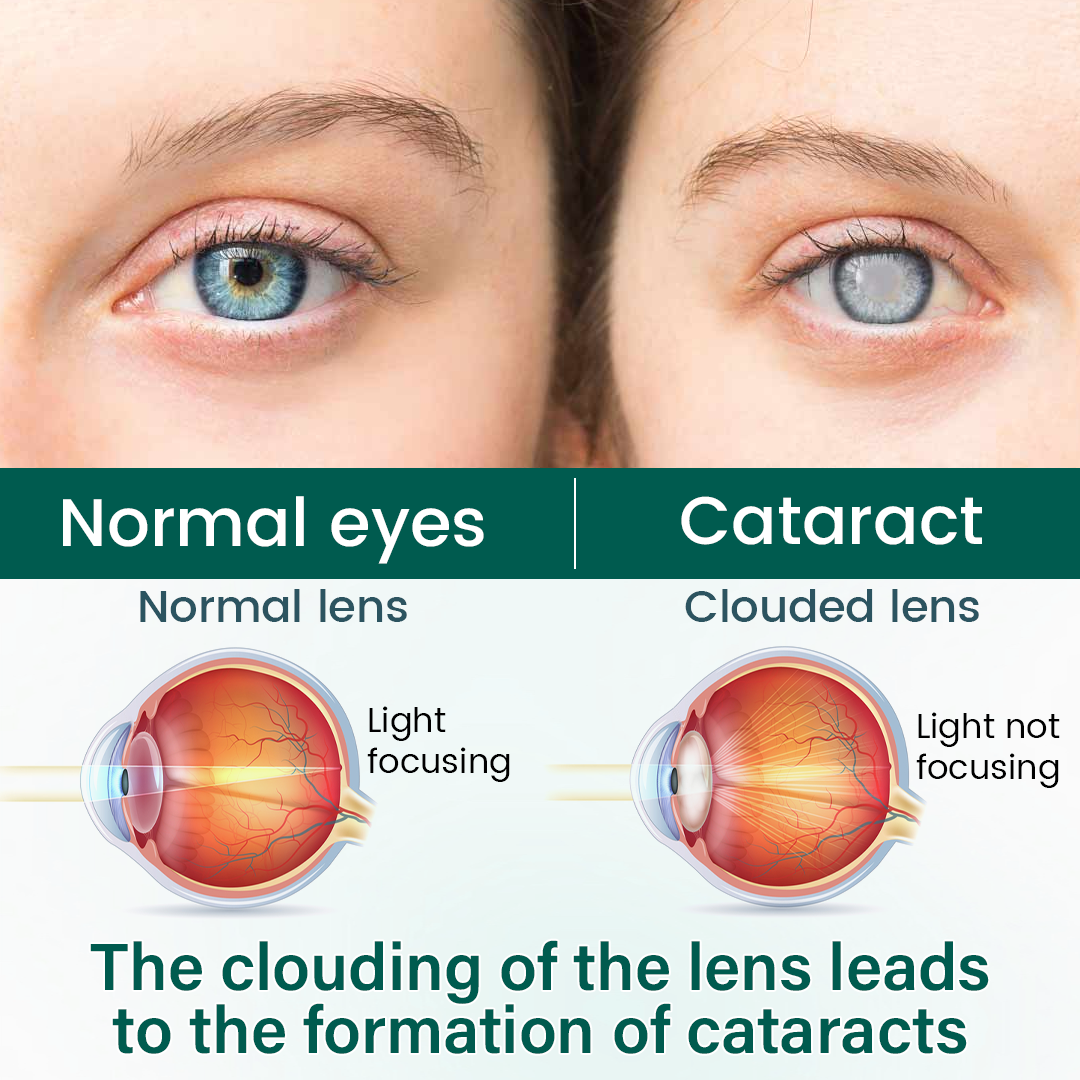 NEYEROS® OptiClear Nano Eye Roller Serum