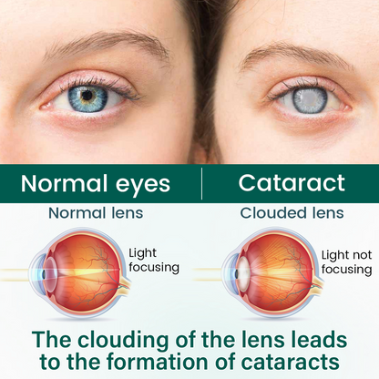NEYEROS® OptiClear Nano Eye Roller Serum