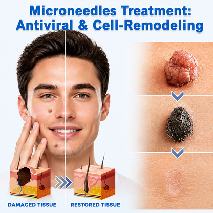 🔥Muwix®2-in-1 Microneedle & Hydrocolloid Patch🍀| Removes Raised Moles, Acne, Flat Warts & Skin Tags | Helps Improve Wrinkles, Scars & Blemishes | Invisible Patches for Face & Body