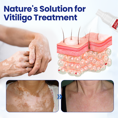 VitiRepair Advanced Spray