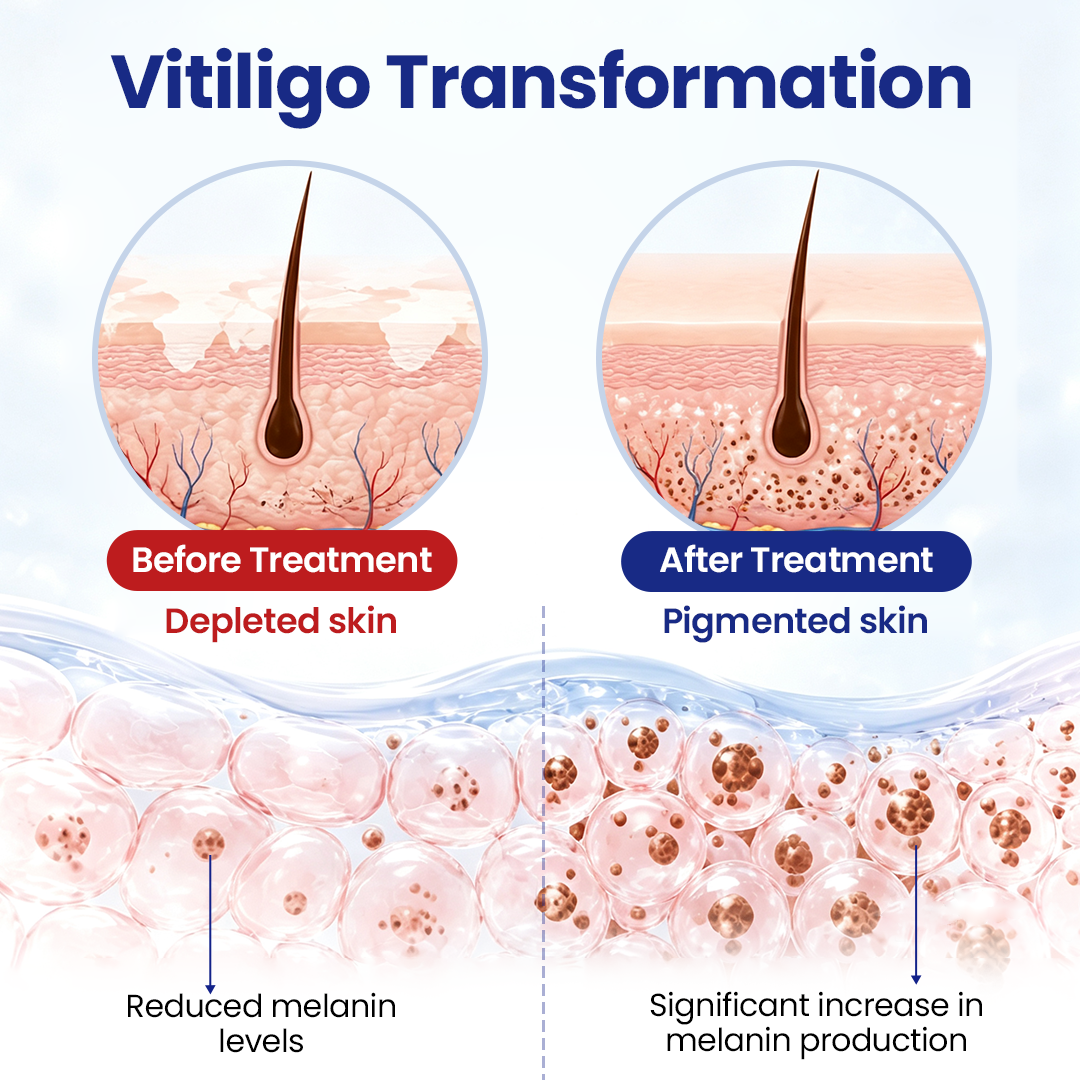 VitiRepair Advanced Spray
