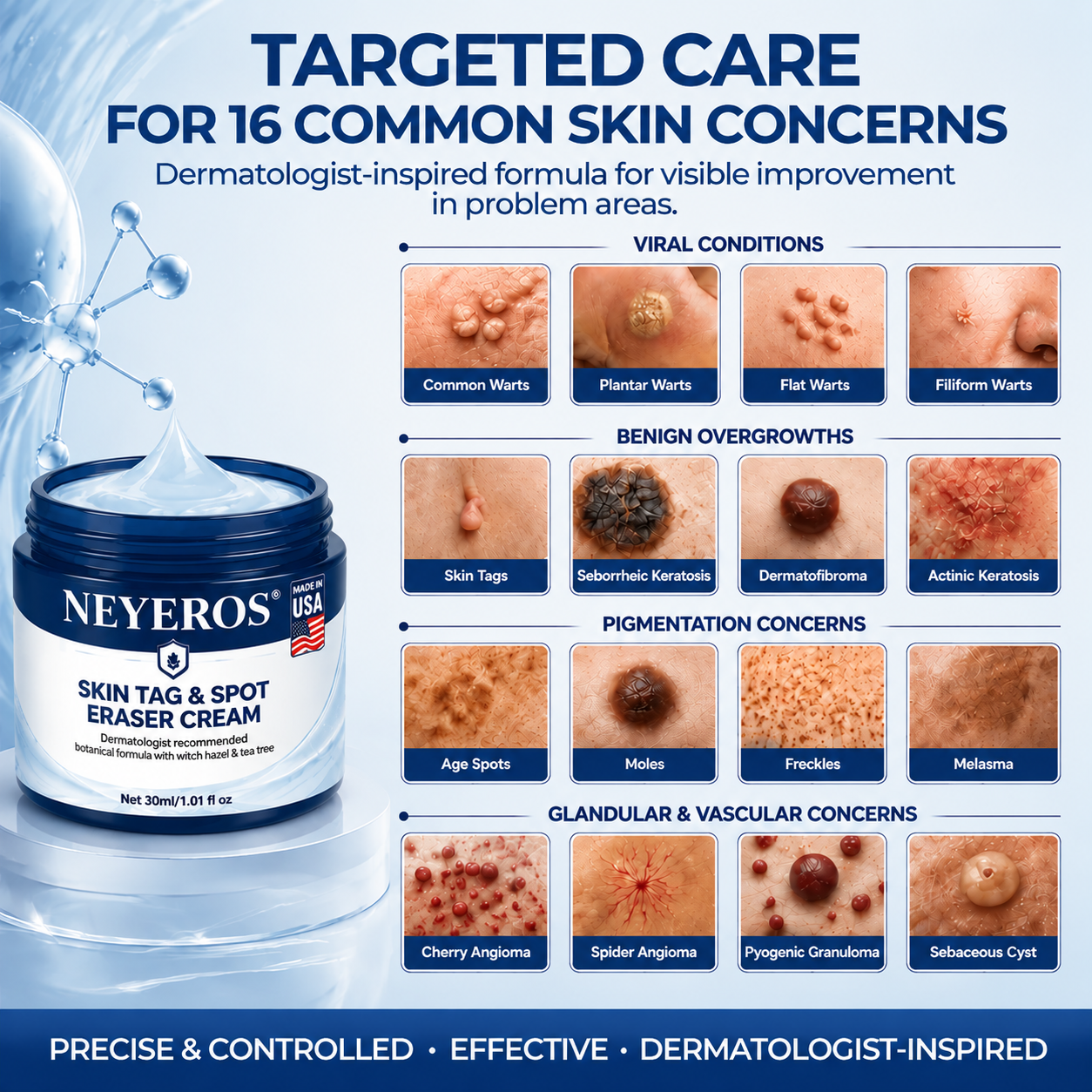 NEYEROS® 7-Day Skin Tag & Spot Eraser Cream