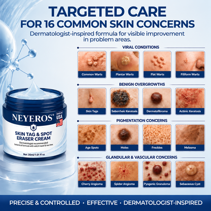 NEYEROS® 7-Day Skin Tag & Spot Eraser Cream
