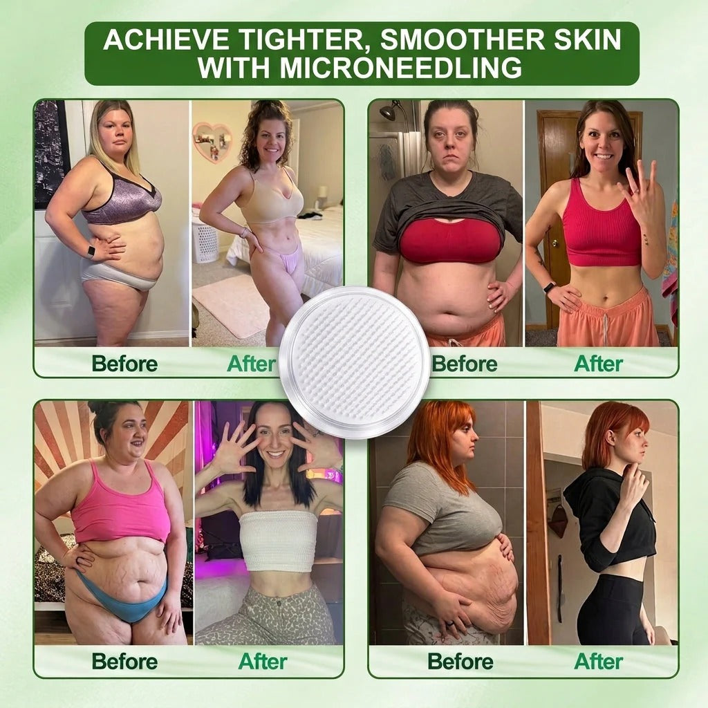 80% OFF | 2026 Upgraded] SolarozaR 5CM Lymphatic Drainage Slimming Patch60% Stronger, 5CM Upgraded Size & 7Day Results-5x Lipolytic Complex: Weight Loss, Lymph Flow, Joints, Sleep & Clarity OFFICIAL STORE