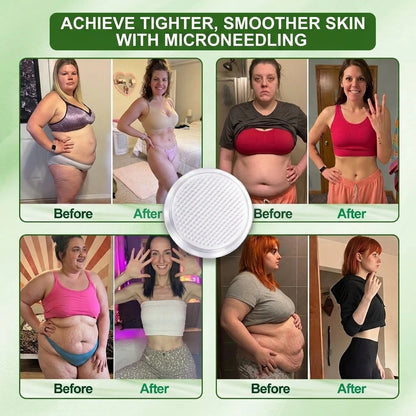 80% OFF | 2026 Upgraded] SolarozaR 5CM Lymphatic Drainage Slimming Patch60% Stronger, 5CM Upgraded Size & 7Day Results-5x Lipolytic Complex: Weight Loss, Lymph Flow, Joints, Sleep & Clarity OFFICIAL STORE